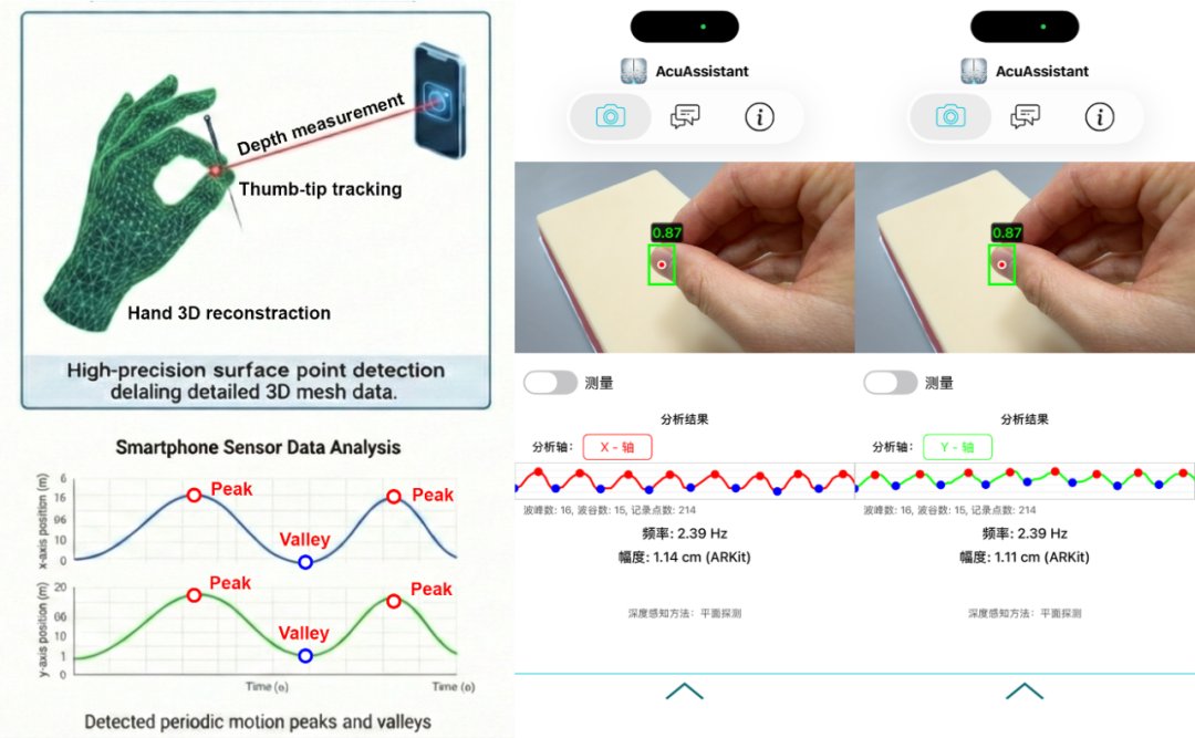 人工智能赋能针灸现代化：校院联合研发的“AcuAssistant”智能针灸应用正式上线